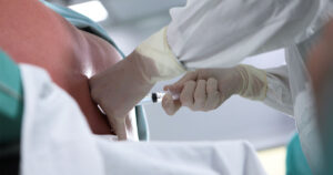 硬膜穿刺硬膜外麻酔法(DPE)って何？